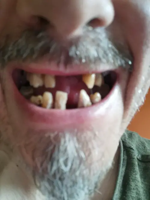 Zahnarzt Kosten gegen Arbeit