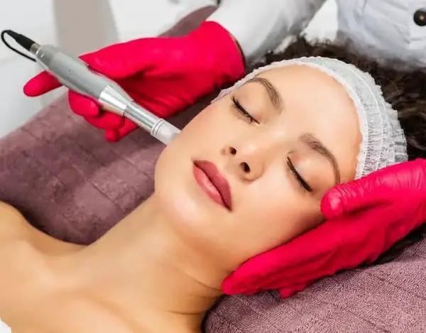 Microneedling Behandlung