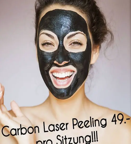  Carbon Laser Peeling