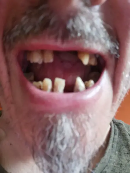 Zahnarzt Kosten gegen Arbeit